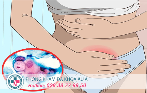 Viêm niệu đạo do vi khuẩn Chlamydia