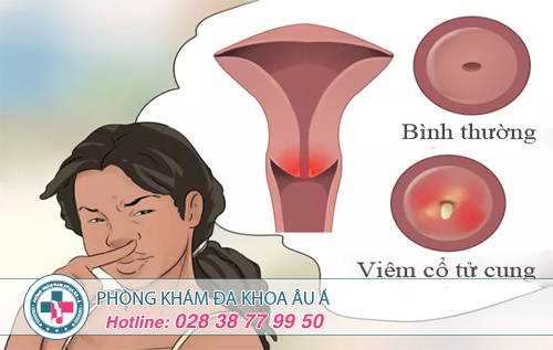 Vì sao vùng kín có mùi hôi?