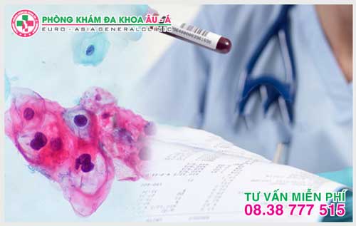 Xét nghiệm bệnh sùi mào gà - cho kết quả Chính Xác trong 15p